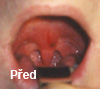 P�ed z�krokem